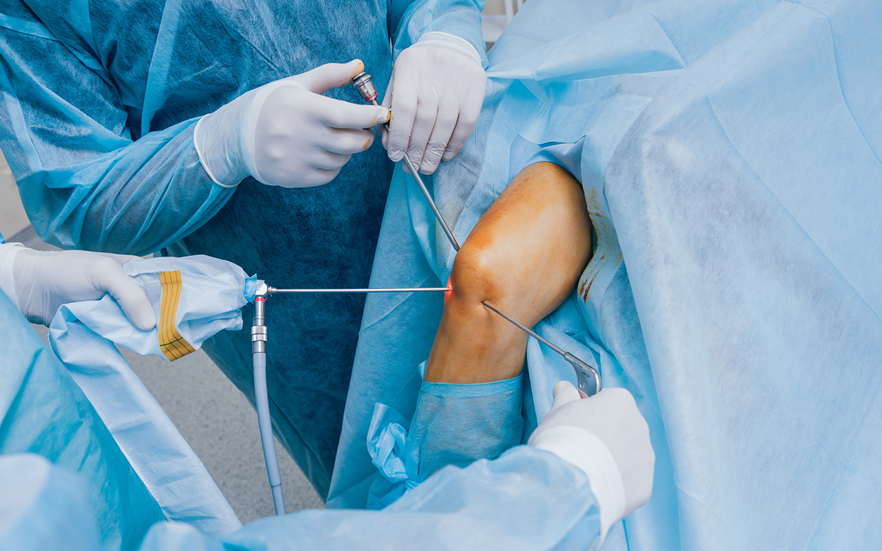 Arthroscopy and Sports Orthopaedics